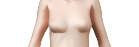 乳房修复术