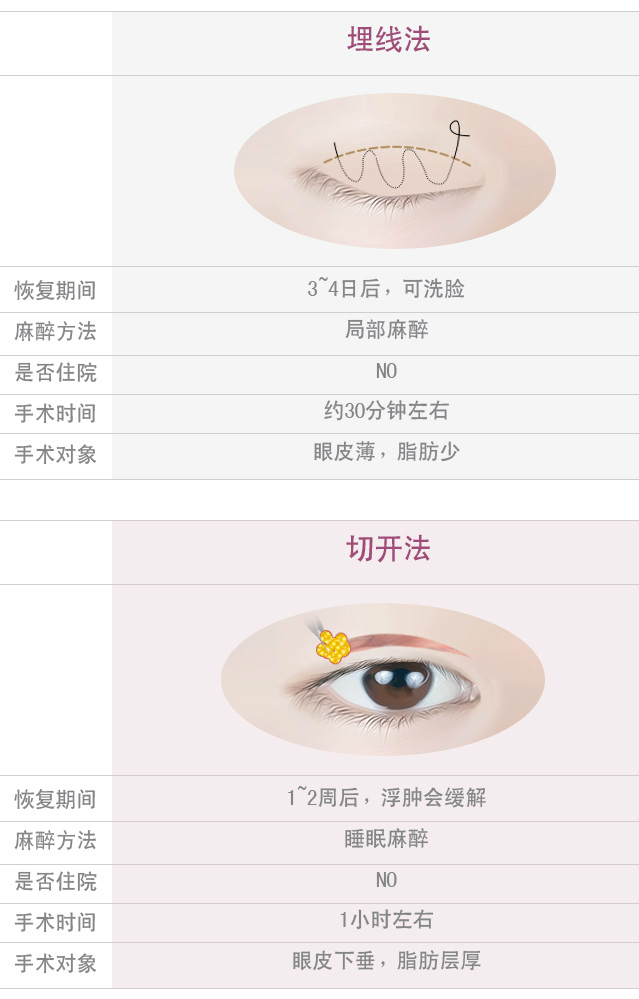 双眼皮