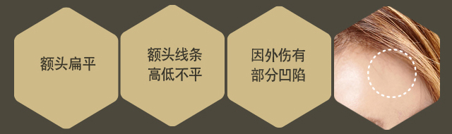 额头