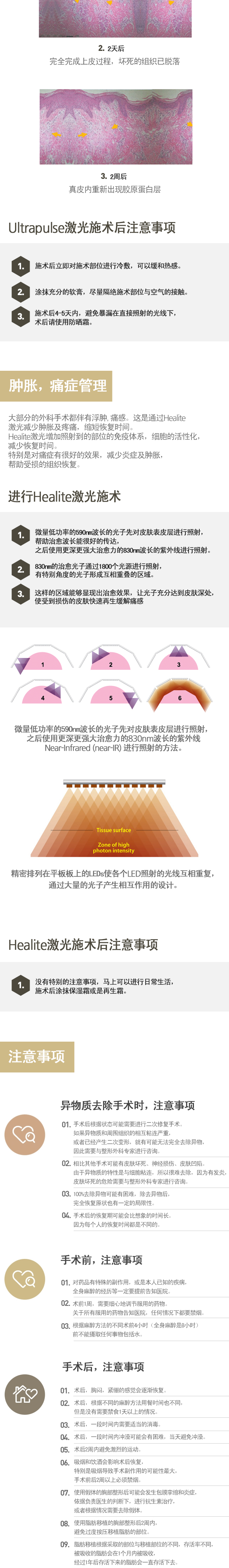 可以去除异物质手术的部位 / 使用自体脂肪移植的复原方法 / 使用假体的复原方法